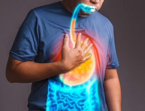 gastroesophageal reflux disease visualized on a person